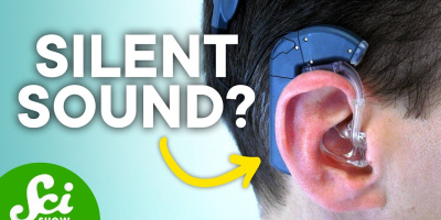 Hur låter cochleaimplantat?