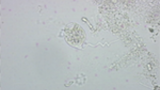 Vorticella äter