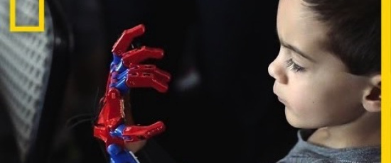 3D-printade proteser ändrar barnens liv