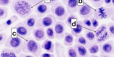 Prov 2026-03-24 om Biologins grunder, Cellens genetik och grundläggande Klassisk genetik