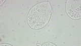 Tetrahymena thermophila