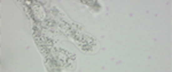 Amoeba proteus