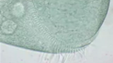 Ciliaten Stentor