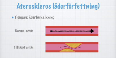 Några hjärt- och kärlsjukdomar