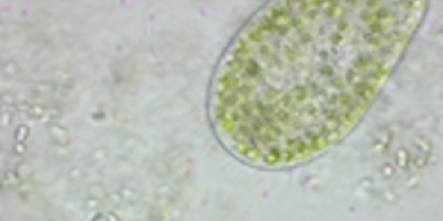 Cilier hos Paramecium bursaria
