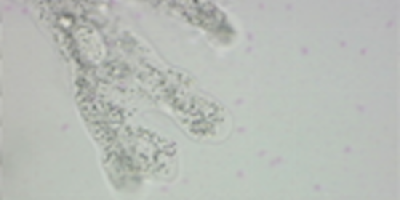 Amoeba proteus