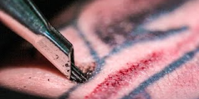 Tatuering i ultrarapid
