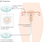  49374970 ivf treatment464