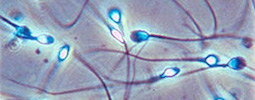 sperm