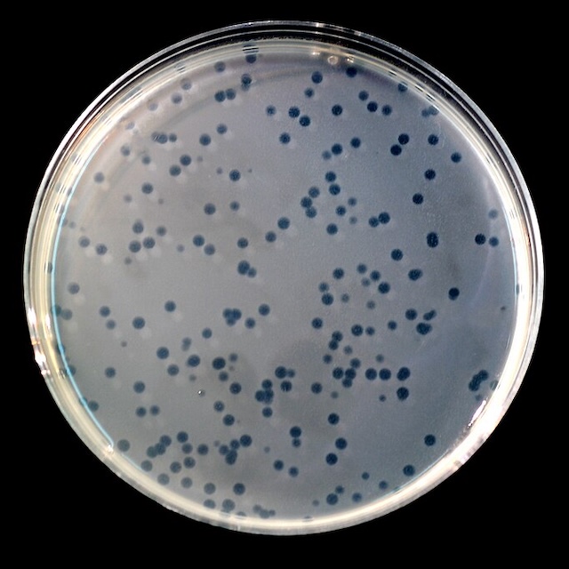 phage-M12-plaque